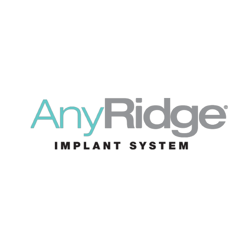 AnyRidge